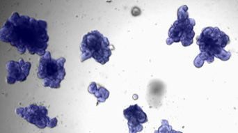 Organoid segmentation with SINAP (deep-learning model).