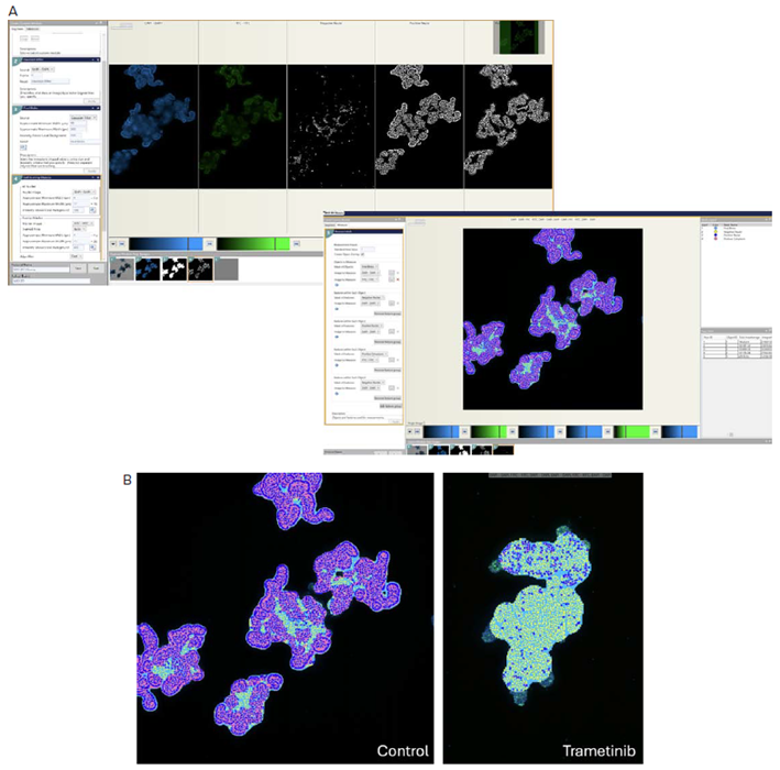 A) CME analysis masks show steps of finding cells with intact cytoskeleton, i.e., positive for actin staining, or damaged cells, i.e., negative (weak) for actin staining. B) Analysis masks are shown for untreated organoids and organoids treated with trametinib. Masks: blue – organoids; yellow – cells with weak actin stain; dark blue – cells with intact actin; pink – cytoplasm of cells with intact actin. Maximum projection images were used for analysis.