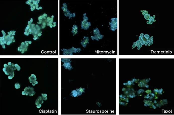Phenotypic changes caused by selected cytotoxic drugs. Confocal images of organoids treated with selected anti-cancer drugs. Samples in the picture were treated with control (0.1% DMSO), mitomycin (10 μM), trametinib (10 μM), cisplatin (10 μM), staurosporine (1 μM), and Taxol (10 μM), respectively. Confocal images were taken with 10X magnification using a Z-stack of 16 images 8 μm apart. Maximum projection composite images shown. Hoechst – blue, Phalloidin – green.