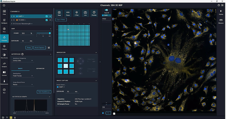 Redesigned image acquisition software (MetaXpress® High-Content Image Acquisition and Analysis Software) offers an intuitive, user-friendly environment that is quick for novices to master while remaining flexible and customizable for advanced users. There are also several new features, including easily controlled transmitted light acquisitions and identification and the centering of “rare” objects in a well for high-magnification acquisition