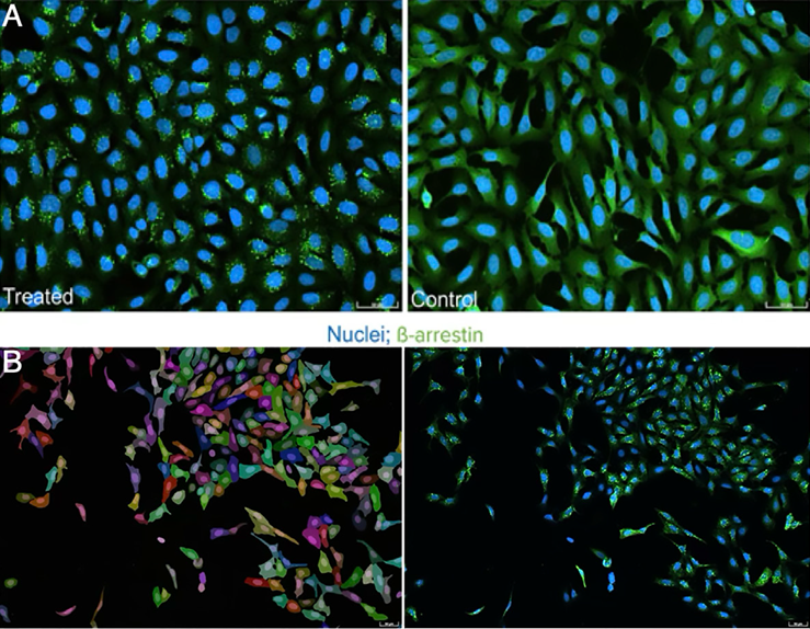 Evaluation of the GPCR assay. (A) Cells with activated GPCR (treated with isoproterenol) shown on the left, negative control on the right. Note the presence of ß-arrestin puncta (green) in the treated samples. (B) Cell masks in random colors, generated using Cellpose 3.0 in the IN Carta image analysis software, were based on DAPI staining and vesicle staining.