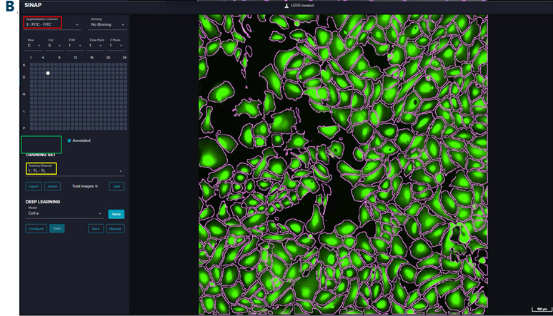 Training interface showing channel selection and segmentation of pretrained models. A) SINAP training interface using DAPI as segmentation channel (red box) and TL as training channel (yellow box). The magenta outlines stand for the nuclei mask generated by the pretrained Nuclei.a model. B) SINAP training interface using FITC (Calcein AM) as segmentation channel (red box) and TL as training channel (yellow box). The magenta outlines stand for cell mask generated by the pretrained Cell.a model. A U2OS cell line was used in this case.