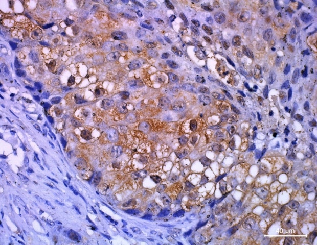 A practical guide to multiplex IHC troubleshooting