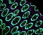 A practical guide to multiplex IHC troubleshooting
