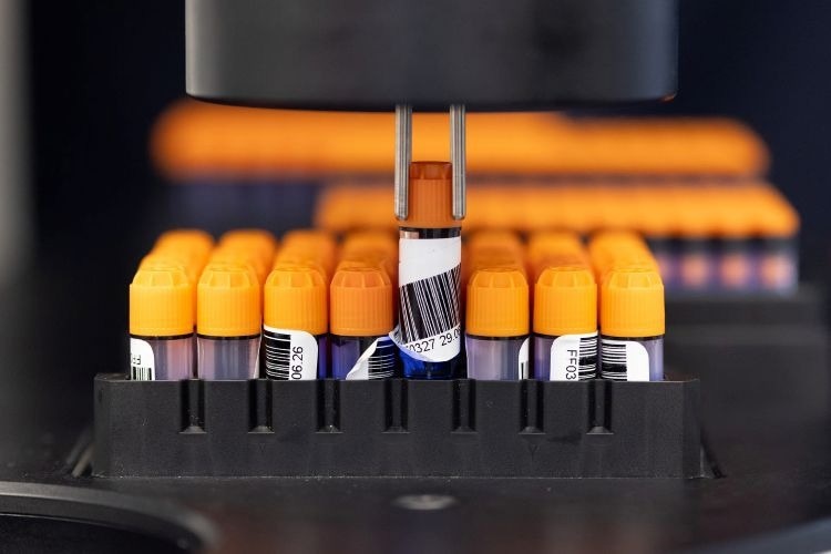 Barcode on a sample tube. Note how it has folded over on itself, potentially causing issues