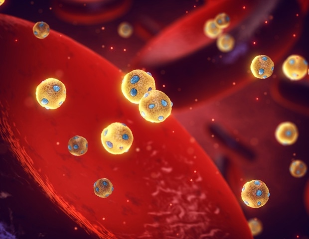 Tracking lipid metabolism with submicron IR