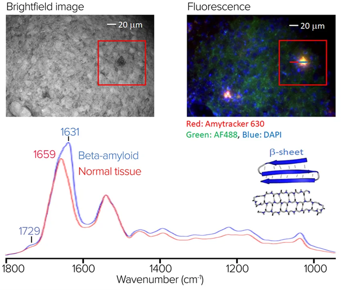 Stained tissue sample with fluorescence image and spectra showing significant spectral differences at 1631 cm-1
