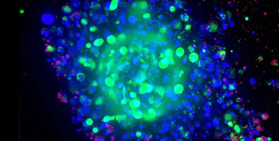 Disease modeling