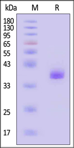 ACROBiosystem's Human Apolipoprotein E / APOE3 Protein, Tag Free (MALS verified)