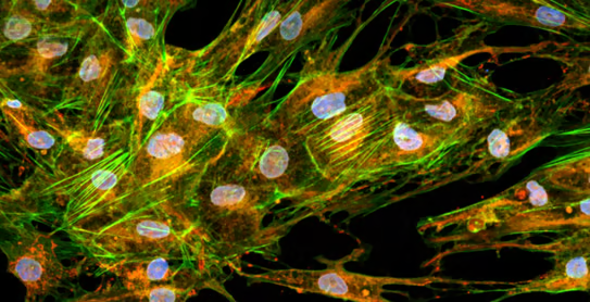 Cell painting image at 60X magnification captured under high-intensity laser illumination.
