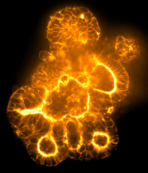 Organoid image acquired with 60 µm. pinhole confocal disk.