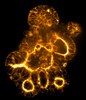Organoid image acquired with 50 µm. pinhole deep tissue disk.