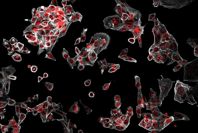 PC-12 cells captured at 40X magnification.
