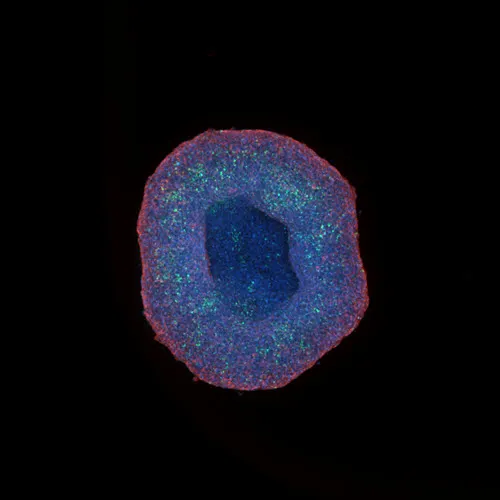 HepG2 spheroid acquired at 10X magnification.