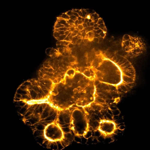 Organoid image acquired at 20X magnification.