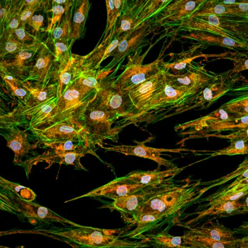 Cell painting assay at 60X magnification.