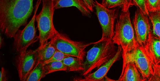 Cell painting