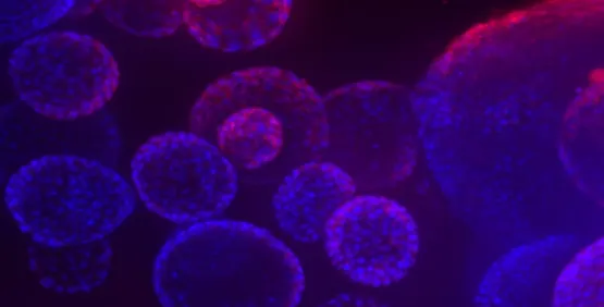 Organoids