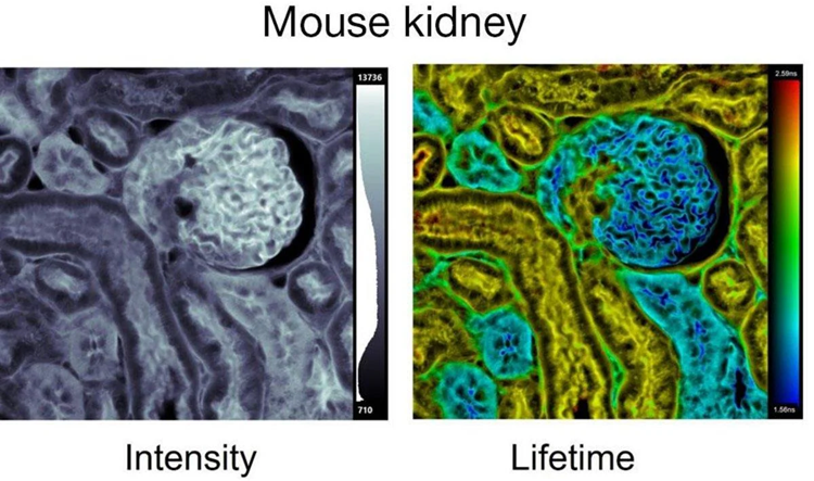 Flexible fluorescence lifetime imaging with InverTau Meta