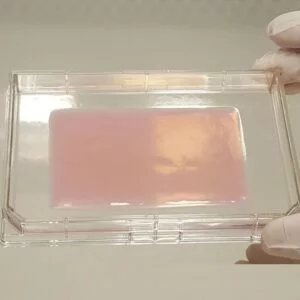 Full-thickness autologous skin tissue.