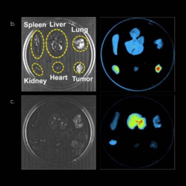 Spleen, Liver, Lung, Kidney, Heart, Tumor.