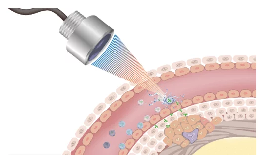Microbubble contrast agents for ultrasound imaging illustration
