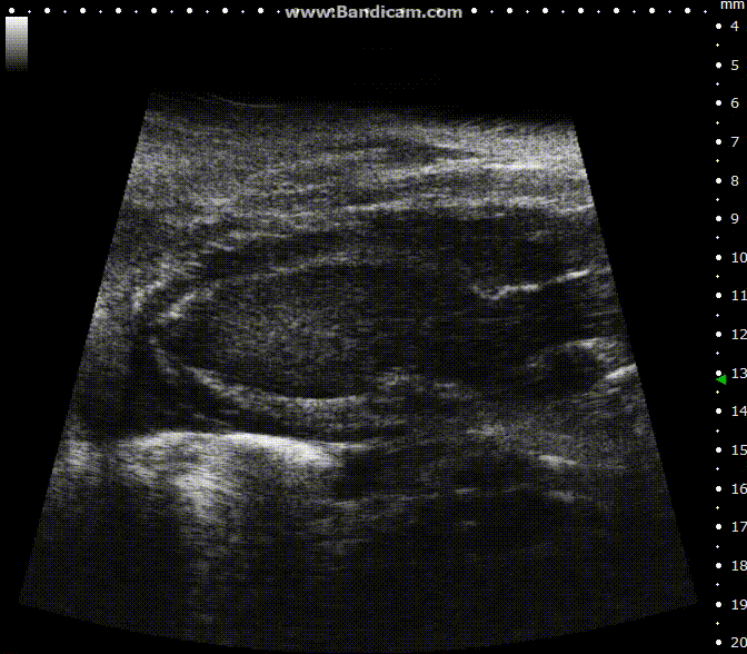High-frequency ultrasound system for preclinical imaging