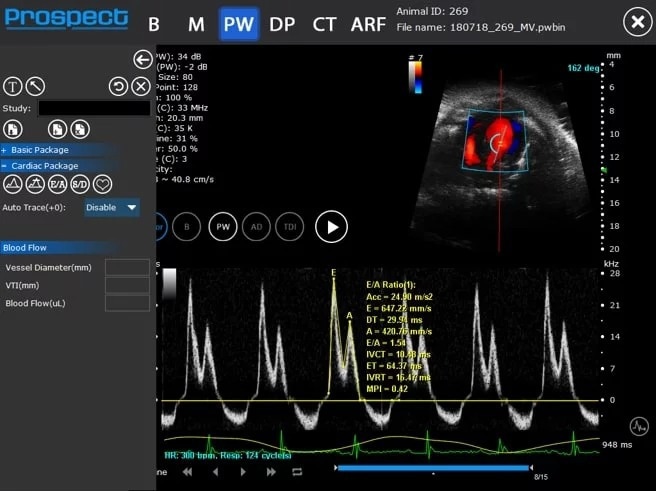 High-frequency ultrasound system for preclinical imaging