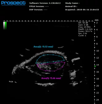 High-frequency ultrasound system for preclinical imaging