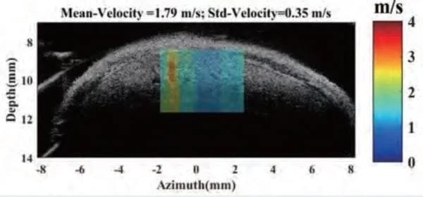 Shear Wave Elastogram showing focal lesion in mouse liver.
