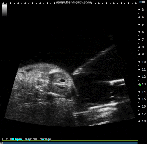 Image Guided Injection, with Pulled Glass Capillary Needle, into Externalized Mouse Embryo.