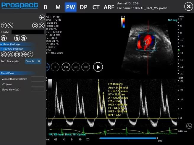 Mouse Mitral Valve Inflow in PW Doppler with Measurements to Calculate Diastolic Function.