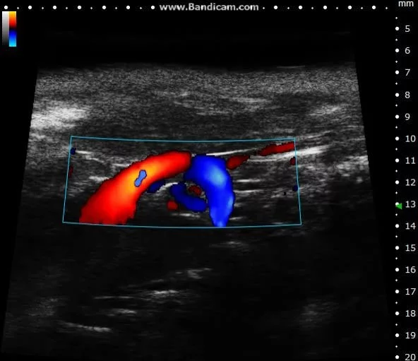 Mouse Aortic Arch in Color Doppler.