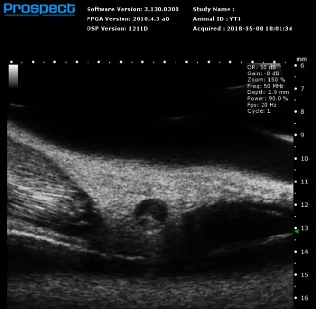 Mouse Inguinal Lymph Node in B-Mode.