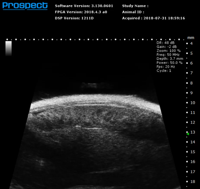 Mouse Spleen in B-Mode