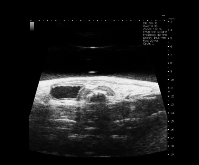 Mouse Uterine Horn in B-Mode.
