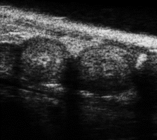 Mouse E7.5 Embryos in B-Mode.