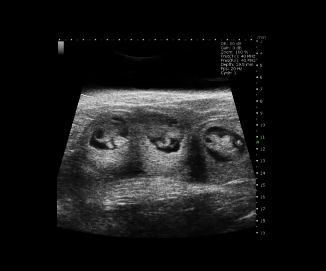 Mouse E10 Embryos in B-Mode.