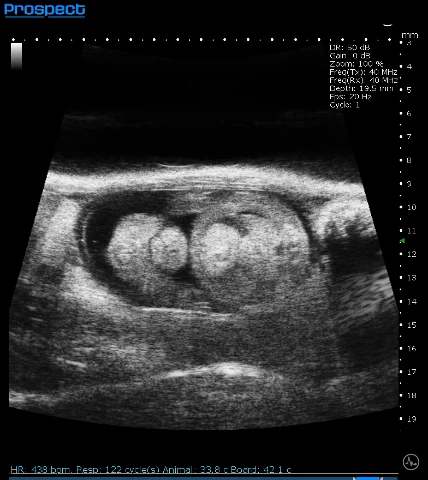 Mouse E15 Embryo in B-Mode.