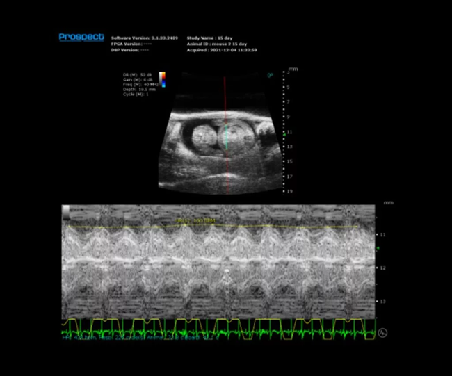Mouse E15 Embryo in M-Mode with Heart Rate Measured.