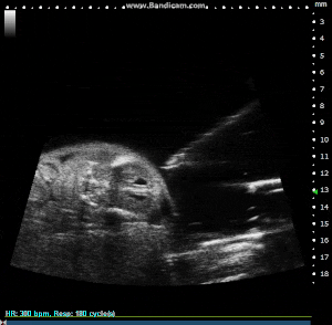 Mouse E15.5 Externalized Embryo with Image Guided Injection.