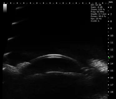 Rabbit Anterior Structure of Eye in B-Mode.