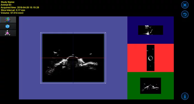 Mouse Eye in 3D B-Mode.