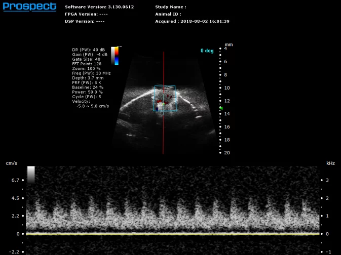 Mouse Retinal Artery in PW Doppler.