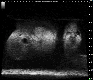 Chick Embryo Day 7 in B-Mode.