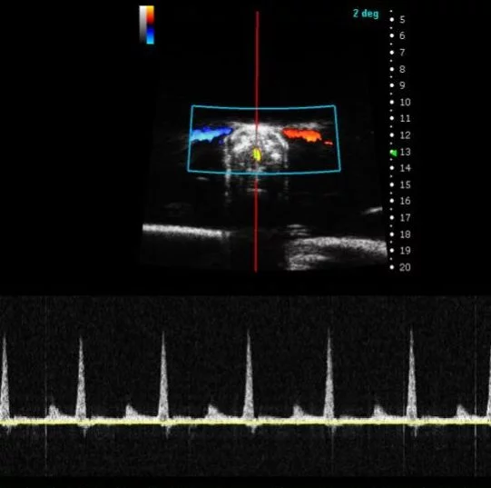 Zebrafish Heart in PW Mode.