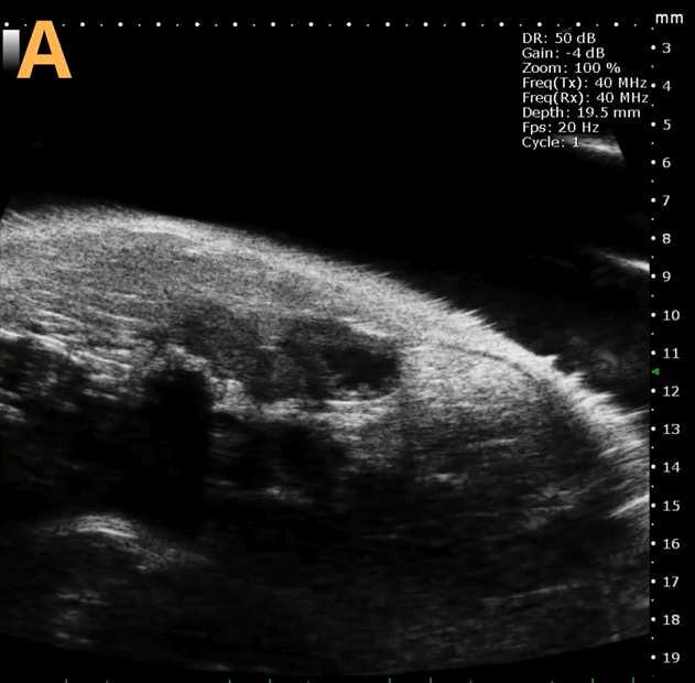 High-frequency ultrasound system for preclinical imaging
