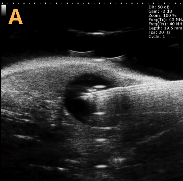 High-frequency ultrasound system for preclinical imaging