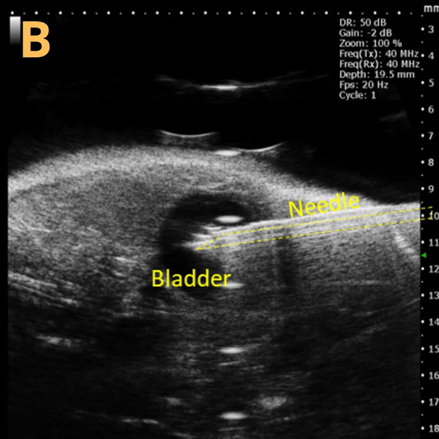 High-frequency ultrasound system for preclinical imaging