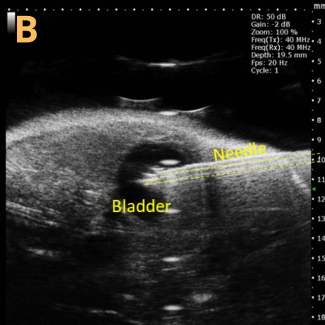 High-frequency ultrasound system for preclinical imaging